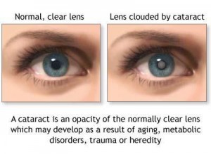 Most common eye problems in kids