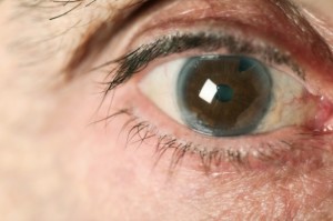 Top 10 lists of most common eye problems 