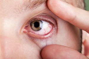 Most common eye problems in the world 