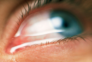 What are the most common eye problems in old age