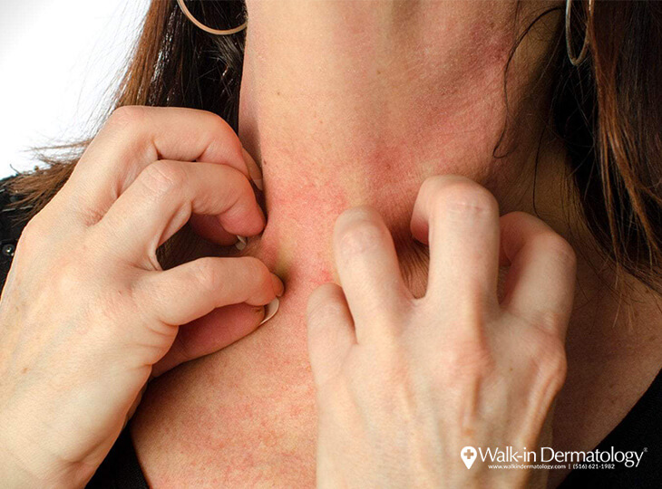 Top 10 rarest allergies